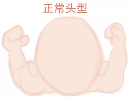 宝宝圆头好还是扁头好？？？？？？这些奥秘好多爸妈都不知路1.webp.jpg